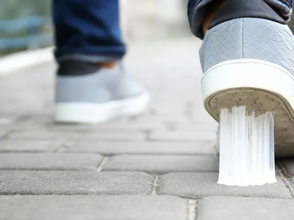 Gum Removal